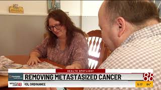 Health Spotlight Removing metastasized cancer [upl. by Helaine]