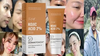 Dermatouch Kojic Acid Cream  Honest Review [upl. by Chute356]