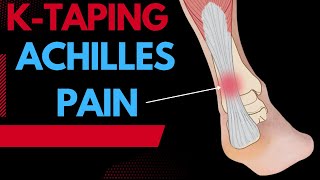 How to treat Achilles Tendonitis using Kinesiology tape [upl. by Ahsienat727]