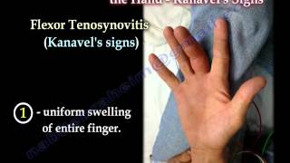 Flexor Tenosynovitis Of The Hand Kanavels Signs  Everything You Need To Know  Dr Nabil Ebraheim [upl. by Acirrehs]