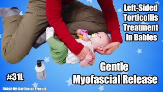 31L Gentle Myofascial Release LeftSided Torticollis Treatment in Babies [upl. by Leod]