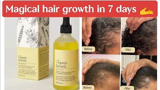 veganic natural hair growth oil review tamil hairfalltreatment [upl. by Oshinski626]