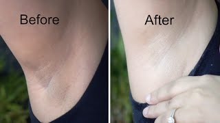 Whiten Dark Underarms in 20 Minutes  Whitening Cream Bleach  Demonstration [upl. by Mima]