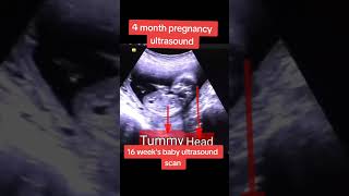 Fetal Heart beat monitoring on ultrasound baby ultrasound abdomen pregnant [upl. by Arahsat120]