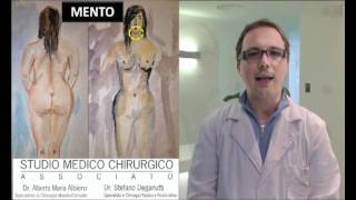 Liposuzione  Liposcultura  Dr Stefano Deganutti [upl. by Ybbil595]