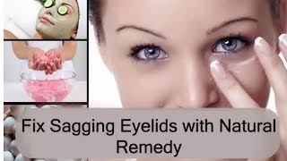 Lift Your Droopy Eyelids In Less Than 10 Days  how to fix droopy eyelids without surgery [upl. by Hollenbeck909]