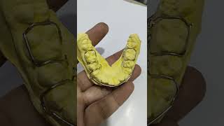 Wire Bending Technique Of Removable Orthodontic Appliance retainer dentalartbyhaider [upl. by Elita588]