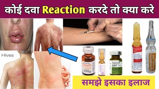 दवा Reaction होने पर क्या करे   Medicine Reaction Treatment  Drugs Reaction का इलाज [upl. by Nnylatsirk]