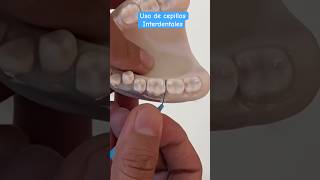 Uso de cepillos interdentales shorts cepillointerdental cepillosinterdentales tepe tepemx [upl. by Vinson610]