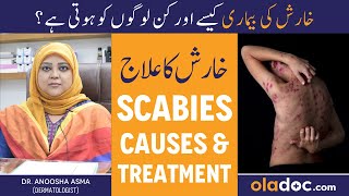 KHARISH KA ILAJ  Scabies Treatment In Urdu  Kharish Ki Bimari Kyun Hoti Hai  Itching Solution [upl. by Falito]