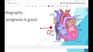 valvular heart disease [upl. by Ingelbert]