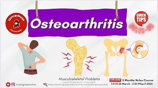 Osteoarthritis Musculoskeletal Problems Nclex Quick Tips [upl. by Adniuqal220]