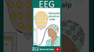 EEG  Electroencephalogram  How EEG works  1 minute pathology [upl. by Vastha]