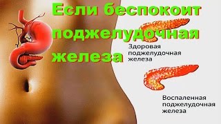 ЕСЛИ БЕСПОКОИТ ПОДЖЕЛУДОЧНАЯ ЖЕЛЕЗА [upl. by Tica]