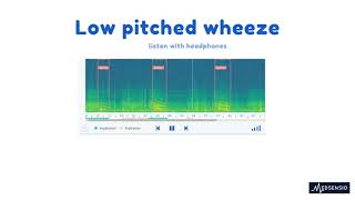 Lung sounds  low pitched wheeze [upl. by Ewold]