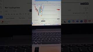 Stock Market me mere Nam ka danka Bazta hai💯😡😎😎stockmarket stock [upl. by Sadoc784]