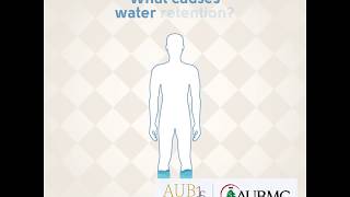 What causes water retention [upl. by Lomaj]