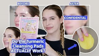 I Tried the Viral Kojic Acid amp Turmeric Cleansing Pads You’ve Seen All Over TikTok  Take My Money [upl. by Mharba]