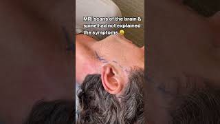 Headaches jaw pain amp facial tension caused by nerve entrapment [upl. by Socher529]