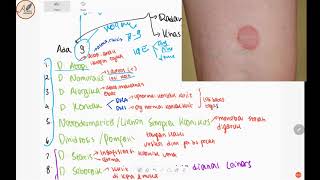 9 Jenis Dermatitis  Review Singkat Klasifikasi Dermatitis [upl. by Neirod]