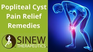 Popliteal Cyst Pain Relief Remedies [upl. by Waneta]