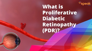 What is Proliferative Diabetic Retinopathy PDR [upl. by Yregerg]