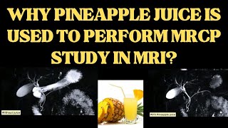 MRCP study main pineapple juice ka use kyun karte hain  why do we use pineapple juice in MRCP study [upl. by Cris641]