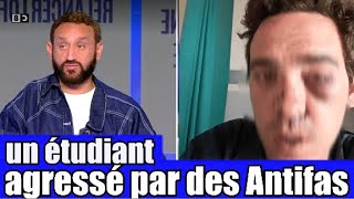 Un étudiant Agressé par des Antifas dans son université 😡 le Tshirt anti J  UIF 🤦‍ TPMP réaction [upl. by Essilec245]