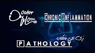 CHRONIC INFLAMMATION GRANULOMA  Doctor HOopa  Pathology زي اللي فالكتاب [upl. by Eileek]