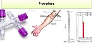 ESR  Erythrocyte sedimentation rate  Physio lab practical  urduhindi [upl. by Assirol]