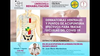 Dermatomas Ventrales y puntos de Acupuntura Efectivos [upl. by Naleag]