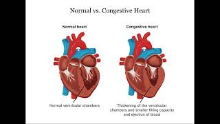 CHF vs Respiratory Failure Crucial Differences [upl. by Marbut]