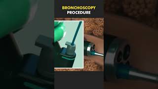 bronchoscopy procedure bscnursing ytshorts medicalstudent doctor lungs nursing [upl. by Tavish]