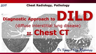 CT Diagnostic approach to DILD diffuse interstitial lung disease [upl. by Modestia]