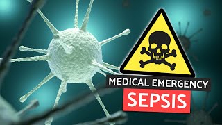 SEPSIS for Medical Finals  Medical Emergencies Made Easy [upl. by Lilac]