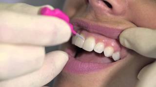 How to use an interdental brush  AJ Hedger [upl. by Dawn]