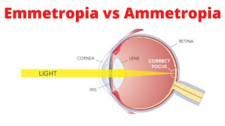 Emmetropia vs Ammetropia [upl. by Bremble193]