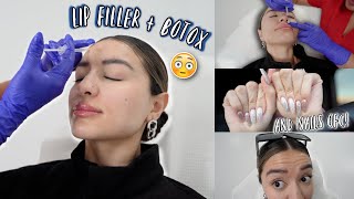 I GOT MY LIPS DONE and botox  makeover vlog [upl. by Amandy]