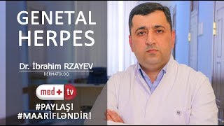 Genetal herpes virusu  Dermatoloq Ibrahim Rzayev  MEDPLUS I2 [upl. by Mateusz530]