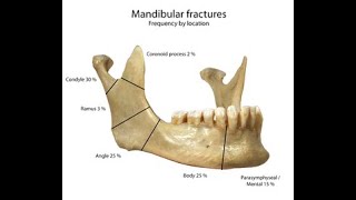 Oral SurgeryTrauma SurgeryFacial pain INBDEBDSMDS [upl. by Catlin]