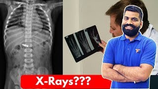 XRays The Powerful Waves XRays Explained [upl. by Noisla]