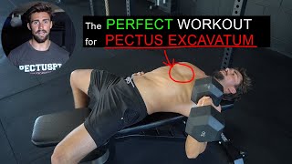 Do THIS WORKOUT to Improve Pectus Excavatum [upl. by Laban]