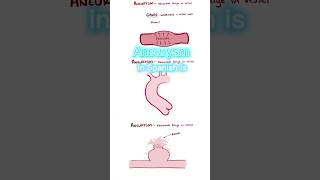 ANEURYSM IN SPANISH  Medical Consecutive Interpreting [upl. by Moran257]