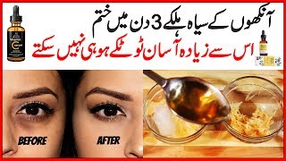 Remove Dark Circles Natural Home Remedies Also Get Rid of Under Eye Wrinkles in 3 Days Urdu Hindi [upl. by Stefano]