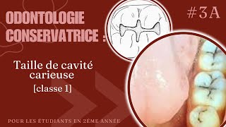 odontologie conservatrice  la taille de cavité classe 1 [upl. by Conal]