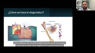 Sindrome mielodisplásico o MDS en palabras simples [upl. by Melvina]