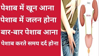 पेशाब में जलन दर्दबारबार पेशाब आना और ब्लीडिंग होनाRK Healthy Tips [upl. by Ennovi]