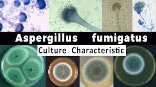 Aspergillus Fumigatus Culture Characteristic [upl. by Ardnekahs]