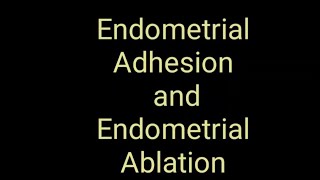 Endometrial Adhesion and Endometrial Ablation on ultrasound Imaging [upl. by Gerri23]