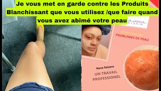 JE VOUS METS EN GARDE CONTRE LES PRODUITS BLANCHISSANTS QUI BRÛLENT VOS PEAUX MESDAMES QUE FAIRE SI [upl. by Hrutkay]